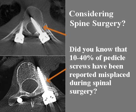 Considering Spine Surgery?